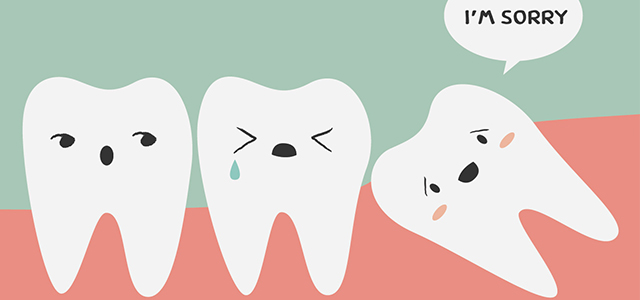 impacted wisdom teeth